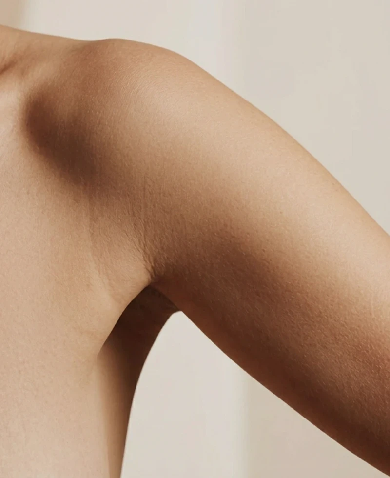 Discreet bovenarmbeeld voor armlift.
