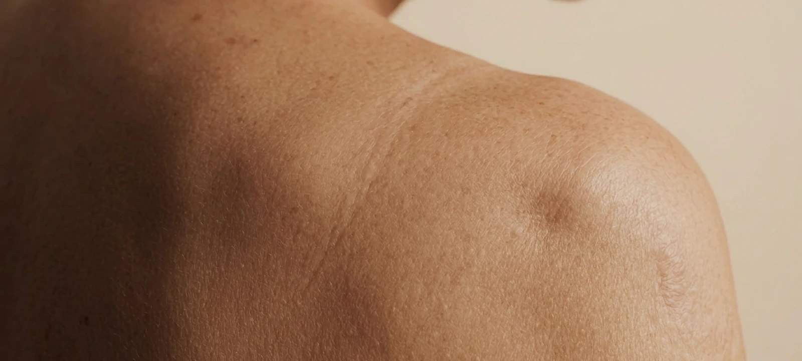 Burn care atmosphere image