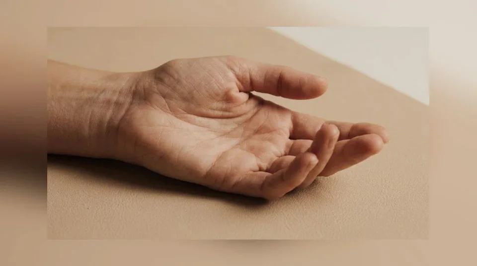 Close-up van een handpalm met een zichtbare streng of knobbel bij Dupuytren.
