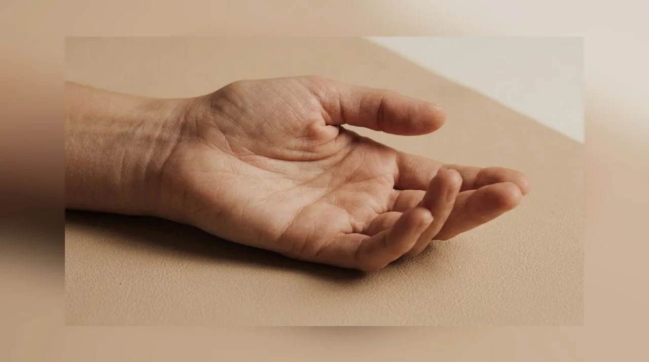 Close-up van een handpalm met een zichtbare streng of knobbel bij Dupuytren.