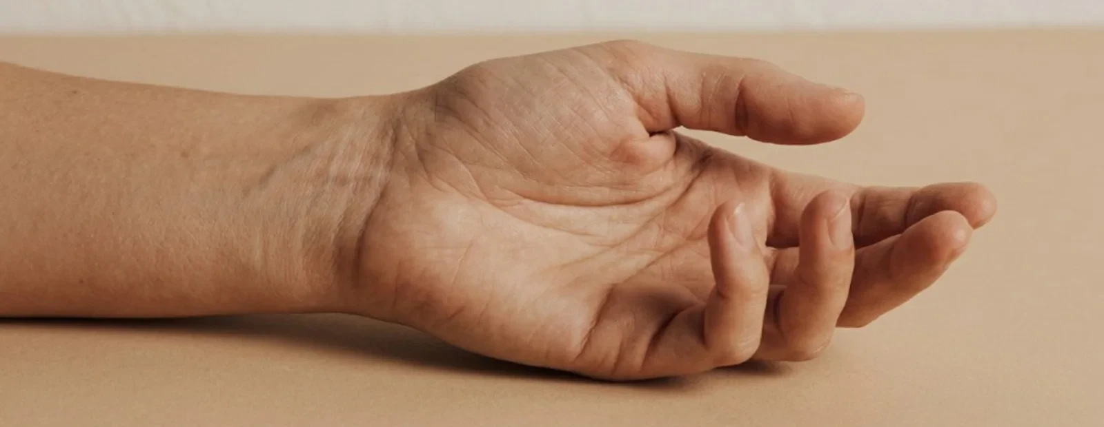 Detail van handpalm en huidtextuur voor Dupuytren.