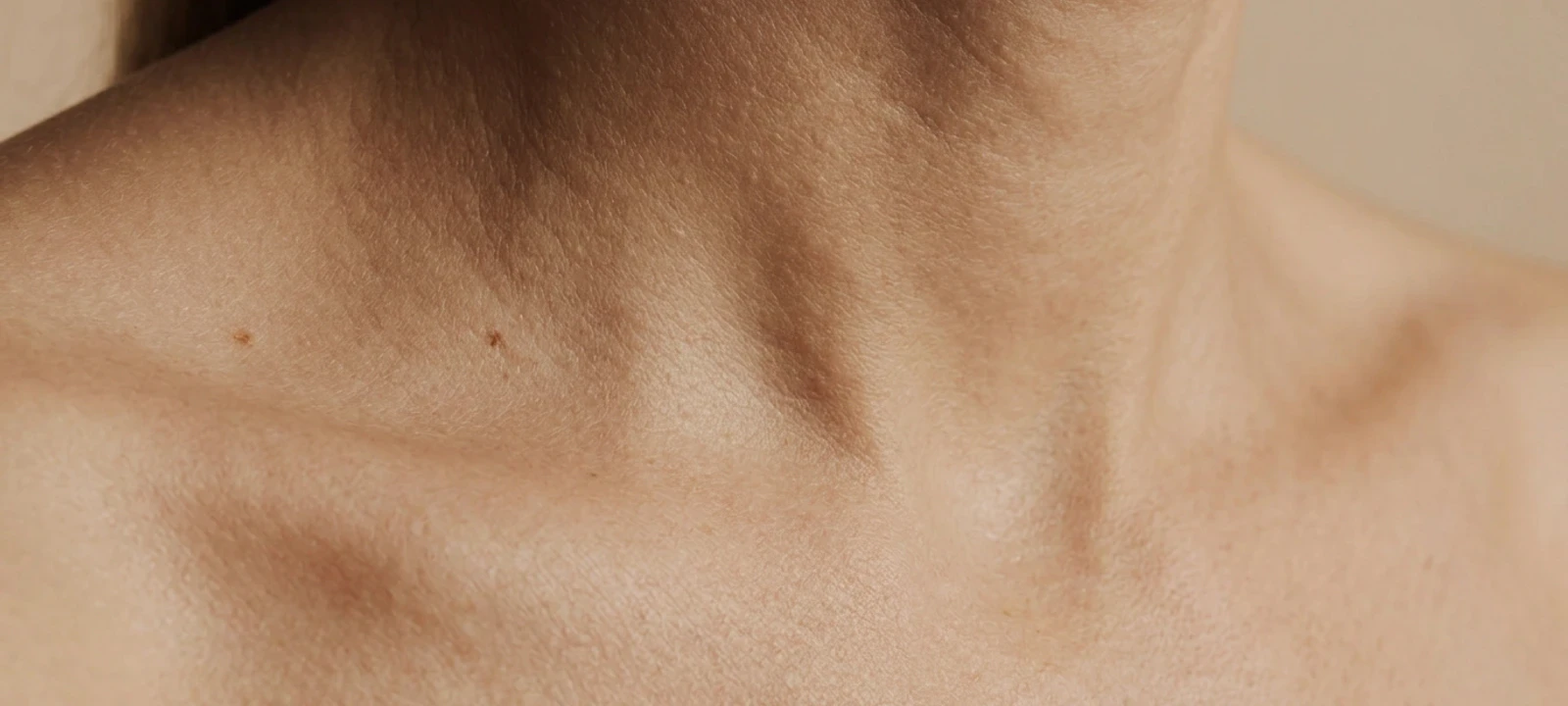 Skin lesion removal atmosphere image
