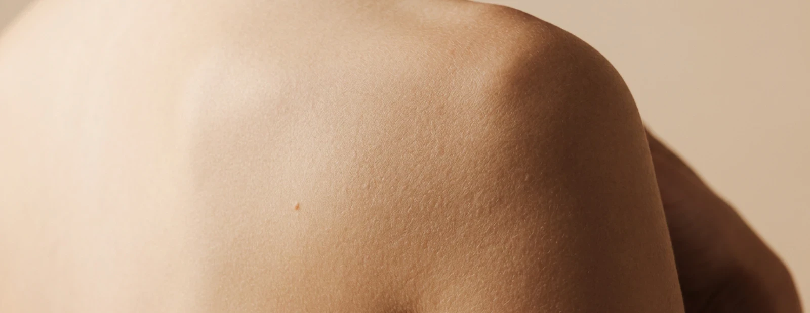 Discreet huidbeeld voor huidletsels.