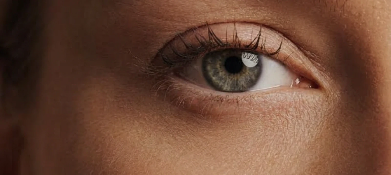 Upper eyelid surgery atmosphere image