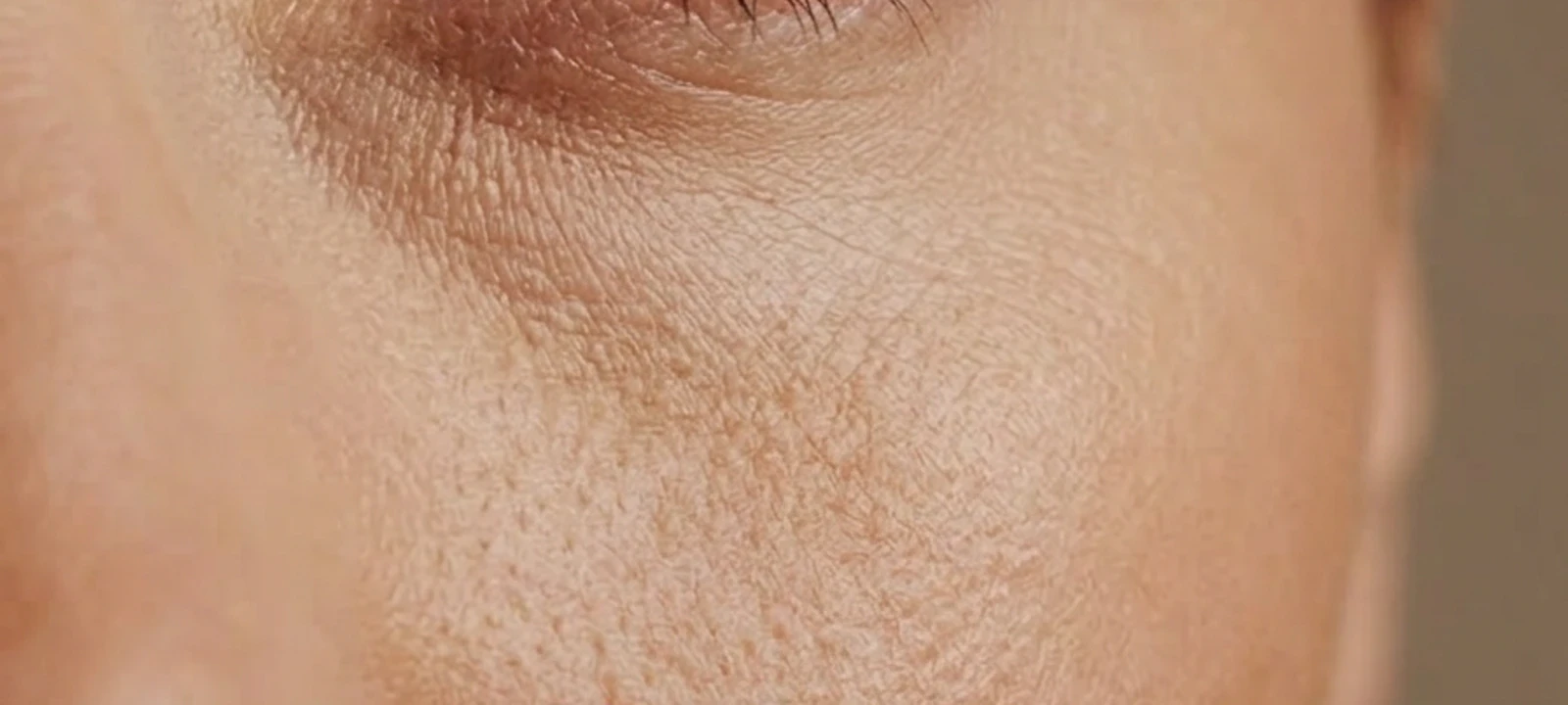 Lower eyelid surgery atmosphere image