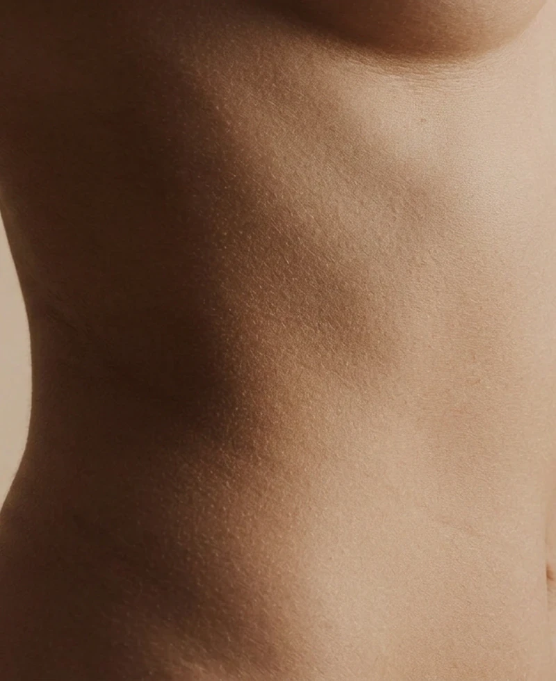 Discreet torso-beeld voor torsoplastie.
